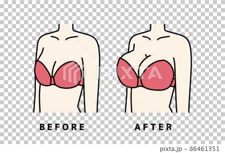 バストアップ バストアップ 86461351