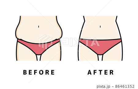ダイエット　下半身 86461352