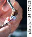 Dental Prosthesis 86477412