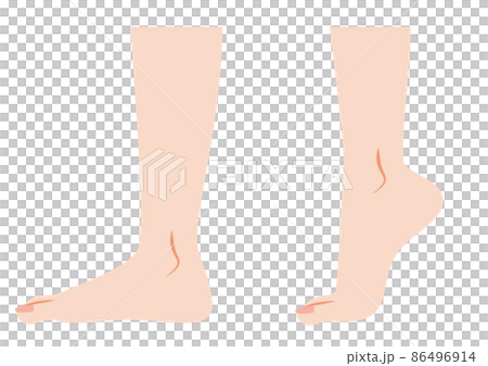 Standing on tiptoe, raising heels 86496914