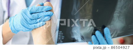 Doctor looking at xray of foot and examining patient leg closeup Doctor looking at xray of foot and examining patient leg closeup 86504927