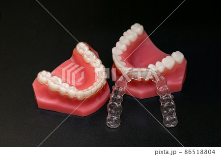 歯科マウスピース矯正イメージ 歯科マウスピース矯正イメージ 86518804