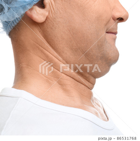 Mature man with double chin on white background, closeup 86531768