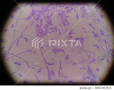 不完全菌類フザリウムの胞子染色 86546303