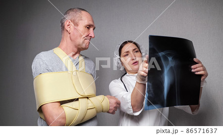 Orthopedist shows x-ray photograph to patient with bandage Orthopedist shows x-ray photograph to patient with bandage 86571637