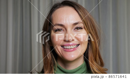 Young brunette woman with braces on teeth smiles widely Young brunette woman with braces on teeth smiles widely 86571641