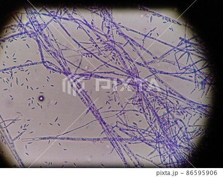 ピンクカビの菌糸 86595906