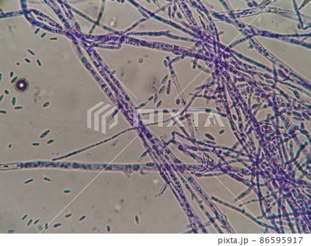 鎌形した胞子 鎌形した胞子 86595917