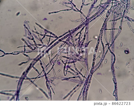 枝分かれするカビの菌糸 枝分かれするカビの菌糸 86622723