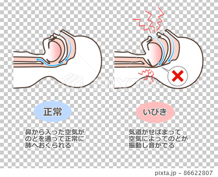Illustrated illustration of snoring - Stock Illustration [86622807] - PIXTA
