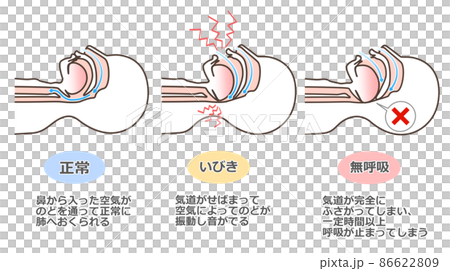 打鼾的插圖 86622809