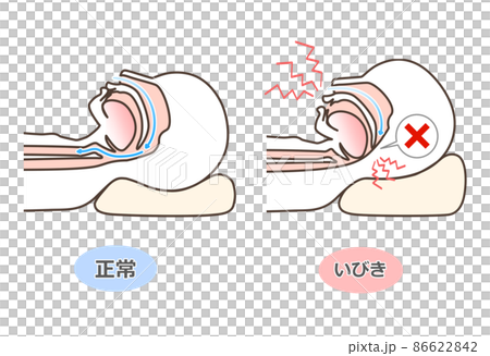 Illustrated illustration of snoring - Stock Illustration [86622842] - PIXTA