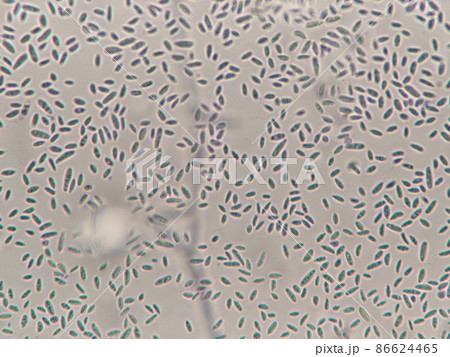 赤カビの胞子 赤カビの胞子 86624465