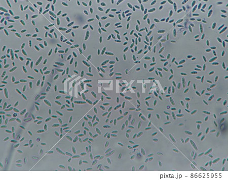 鎌形の胞子の顕微鏡写真 鎌形の胞子の顕微鏡写真 86625955