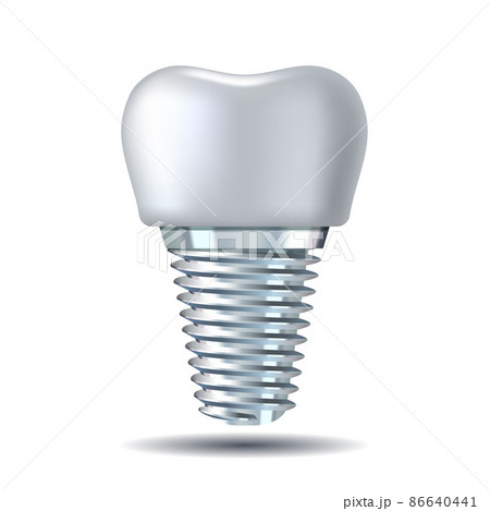 Vector 3d realistic white Tooth Implant. Denture icon closeup isolated on white Vector 3d realistic white Tooth Implant. Denture icon closeup isolated on white 86640441
