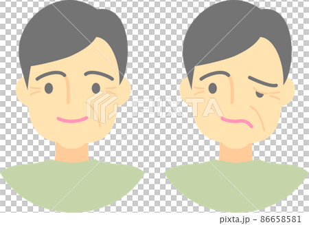 Signs of cerebral infarction, facial paralysis 86658581