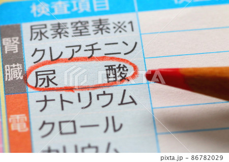 血液検査報告書(尿酸値-痛風の指標) 血液検査報告書(尿酸値-痛風の指標) 86782029