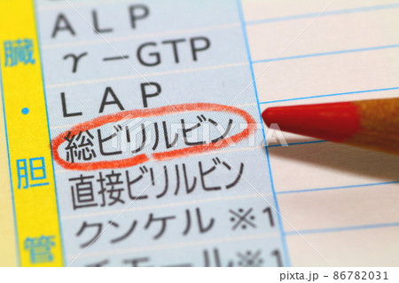 血液検査報告書(総ビリルビン) 血液検査報告書(総ビリルビン) 86782031