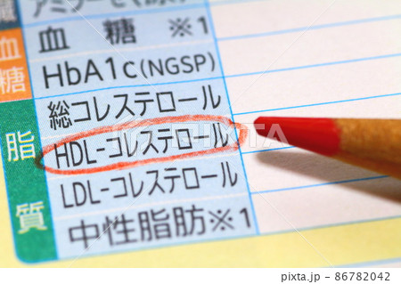 血液検査報告書（HDL・善玉コレステロール） 86782042
