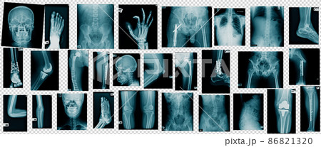hight quality collection x-ray image hight quality collection x-ray image 86821320
