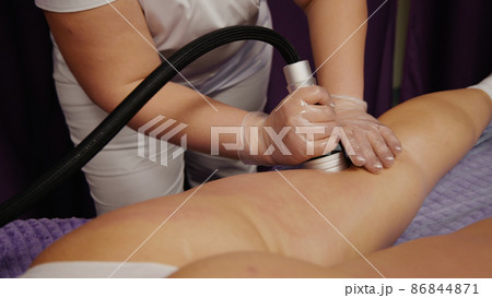 Woman receiving anti-ageing anti-cellulite massage vacuum rf lifting in spa salon. Wellness body and skin care. 86844871