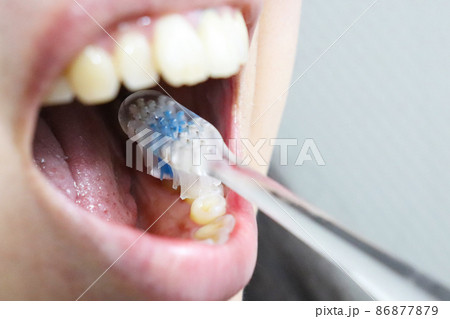 歯磨き 86877879