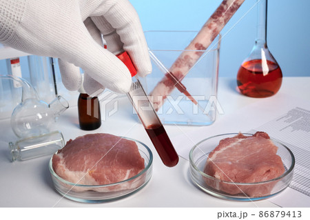 Hand Takes Blood Test Meat Petri - Labs Photo Hand Takes Blood Test Meat Petri - Labs Photo 86879413