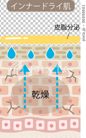 Inner dry skin cross section Inner dry skin cross section 86898681