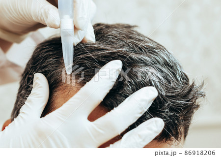 A cosmetologist performs anti-aging procedures, applies hyaluronic acid serum to the scalp, for hair growth 86918206