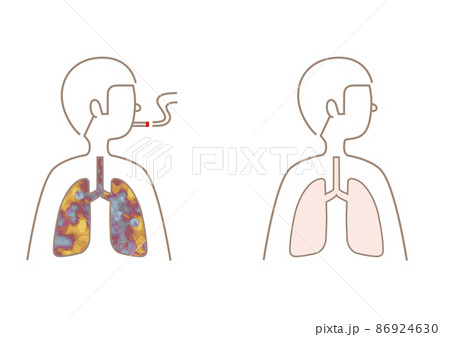 タバコを吸う人・吸わない人 86924630