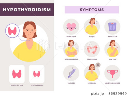 Hypothyroidism disease symptoms infographic with woman character. Underactive thyroid gland. Endocrine system health problem vector poster Hypothyroidism disease symptoms infographic with woman character. Underactive thyroid gland. Endocrine system health problem vector poster 86929949