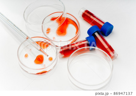 Medical laboratory. Blood coronavirus test.Virus vaccine development.COVID-19.Corona Virus in Lab. Test tube and Petri dish with blood samples on table in laboratory, closeup. Virus research.Close-up. Medical laboratory. Blood coronavirus test.Virus vaccine development.COVID-19.Corona Virus in Lab. Test tube and Petri dish with blood samples on table in laboratory, closeup. Virus research.Close-up. 86947137