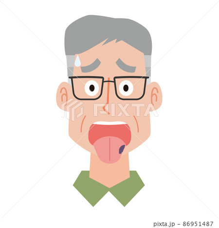 舌がん患者の中年男性 86951487