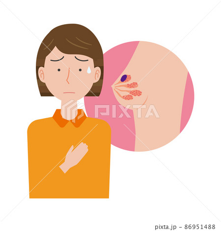 乳がんを心配する女性 86951488