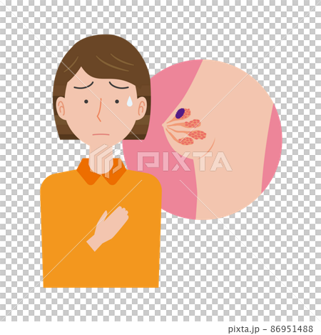 乳がんを心配する女性 86951488