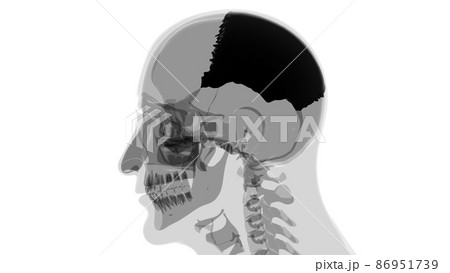 Human Skeleton Skull Parietal Bone Anatomy For Medical Concept 86951739
