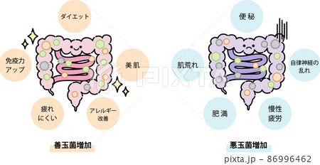 腸内環境のイラスト 86996462