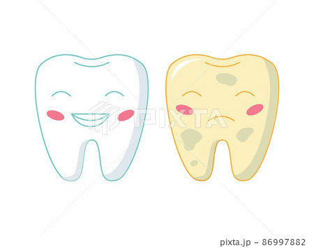 White and yellow tooth. Cartoon teeth characters before and after whitening. Happy healthy and sad bad molars with funny faces. Oral care. Dentistry and hygiene. Vector illustration 86997882
