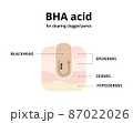 BHA acid for cleaning clogged pores. Removing blackheads, salicylic acid, oily skin. For topics like cosmetology, treatment, exfoliating 87022026