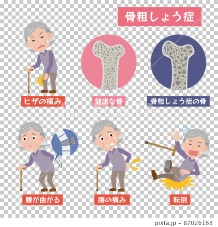 Image of an elderly woman with osteoporosis 87026163