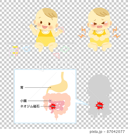 イラスト素材:マグネットパズルの破損で内蔵のネオジム磁石を幼児が誤飲し胃や腸に穴が開く事故 87042077