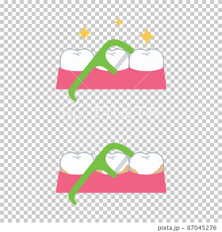 牙線和牙齒 87045276