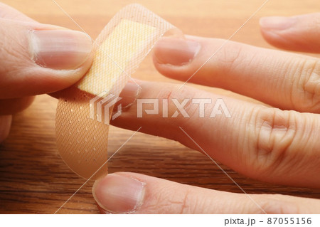 あかぎれが発生した男性の指 87055156