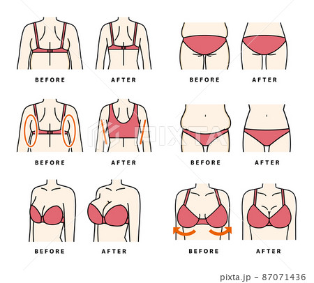 ダイエット バストアップ 補整下着 セットのイラスト素材 [87071436