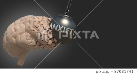 Brain hit by wrecking ball with Anxiety text, medical conceptual 3D rendering 87081741