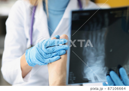 Female doctor examines x-ray of patient legs. 87106664