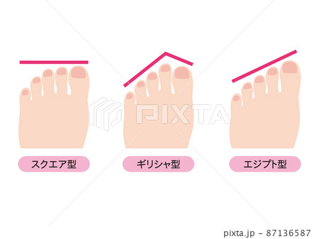 足の形のタイプ 87136587
