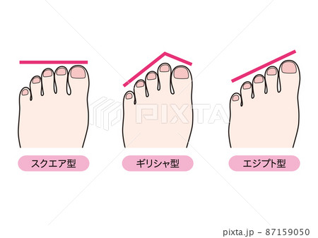 足の形のタイプ 87159050