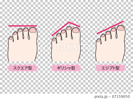 足の形のタイプ 87159050