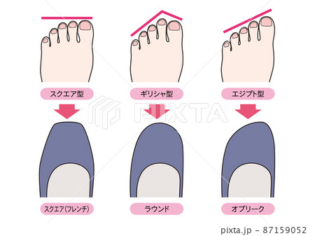 足の形のタイプと靴の選び方 87159052